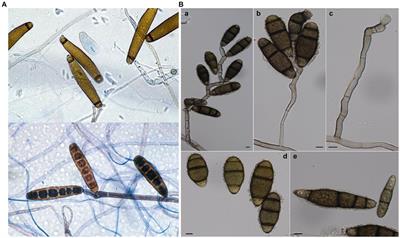 Unveiling Curvularia tuberculata-induced leaf anomalies in Rhododendron ferrugineum: implications in cultural-ecological conservation and harnessing microbial intervention in socio-economic advancement